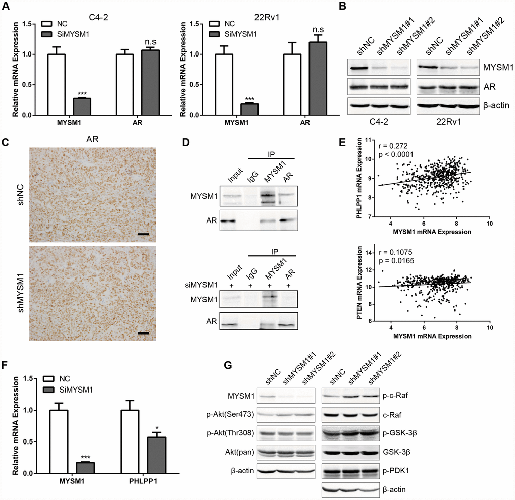 MYSM1 interacts with AR and inhibits activation of Akt/c-Raf/GSK-3β signaling in prostate cancer. (A) qRT-PCR analyses for MYSM1 and AR mRNA levels following transfection of NC/siMYSM1 into C4-2 and 22Rv1 cells. Data are shown as mean ± SEM of 3 replicates. (B) Western blot analyses for MYSM1 and AR protein levels in C4-2 and 22Rv1 cells treated with shNC/shMYSM1. (C) Representative IHC staining images of AR in xenograft tumor tissues. Scale bars are 30 μm. (D) Co-IP assays of MYSM1 and AR in C4-2 cells with (down) or without (up) siMYSM1 treatment. (E) Correlation of MYSM1 with PHLPP1 (up) and PTEN (down) mRNA levels in prostate cancers. Pearson correlation coefficients and significance levels are indicated. Data were collected from TCGA database and analyzed via LinkedOmics bioinformatics. (F) qRT-PCR analyses for MYSM1 and PHLPP1 mRNA levels following transfection of NC/siMYSM1 into C4-2 cells. Data are shown as mean ± SEM of 3 replicates. (G) Western blot analyses of lysates from C4-2 cells treated with shNC/shMYSM1 were probed with the indicated antibodies. n.s = no significance, * P 