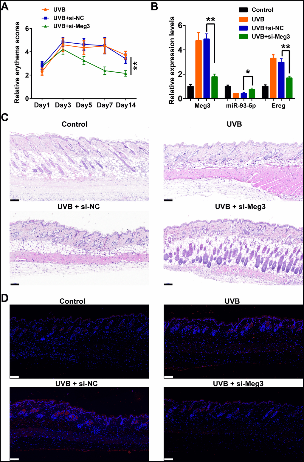 Meg3 siRNA alleviates UVB-induced skin lesions in a mouse model. (A) Measurement of average erythema score of the murine dorsal skin with or without UVB irradiation. Values presented as mean ± SD. (B) Relative expression levels of Meg3, miR-93-5p and Ereg were determined by qRT-PCR. (C) H&E staining of the murine dorsal skin sample after UVB irradiation with or without si-Meg3 treatment (scale bar = 100 μm). (D) FISH of Meg3 in the murine dorsal skin sample after UVB irradiation with or without si-Meg3 treatment (scale bar = 100 μm).