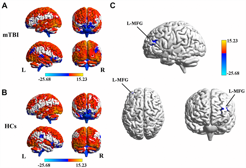 Disrupted brain functional hub and causal connectivity in acute