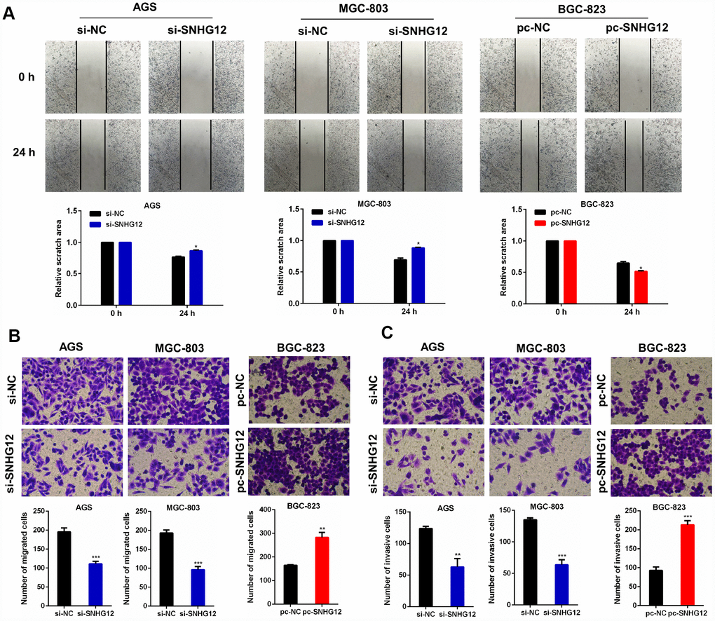 SNHG12 promotes the migration and invasion of GC cells. (A, B) Wound healing and Transwell migration assays were performed to evaluate the migration abilities of AGS and MGC-803 cells transfected with si-SNHG12, and of BGC-823 cells transfected with pc-SNHG12. (C) A Transwell invasion assay was conducted to estimate the invasion abilities of AGS and MGC-803 cells transfected with si-SNHG12, and of BGC-823 cells transfected with pc-SNHG12. The migratory and invasive cells were stained with Hoechst. Data are shown as the mean ± SEM of at least three experiments. *PPP