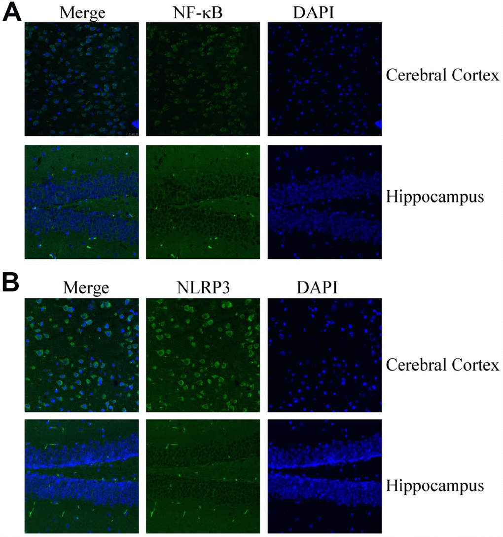 Confocal fluorescence microscopy shows the expression of NF-κB and NLRP3 in the brains of MAPT Tg mice. Images from a single z-plane of the brains of MAPT Tg mice at 6 months of age by using antibodies against NF-κB (A) and NLRP3 (green) (B) and nucleus (blue DAPI stain). Scale bar = 25 μm.