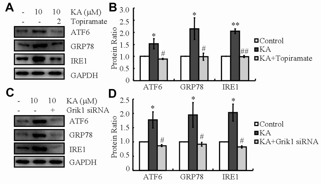 Grik1 mediates KA-induced ER stress. (A, B) N2a cells were treated with 10 μM KA in the absence or presence of 2 μM topiramate for 48 h. (C, D) Grik1 siRNA (200 ng) was transfected to N2a cells before treatment with KA (10 mg/kg). The protein levels of ATF6, GRP78, and IRE1 were determined by western blots. The optical density of bands in western blots was analyzed by Image J software (*P P P 