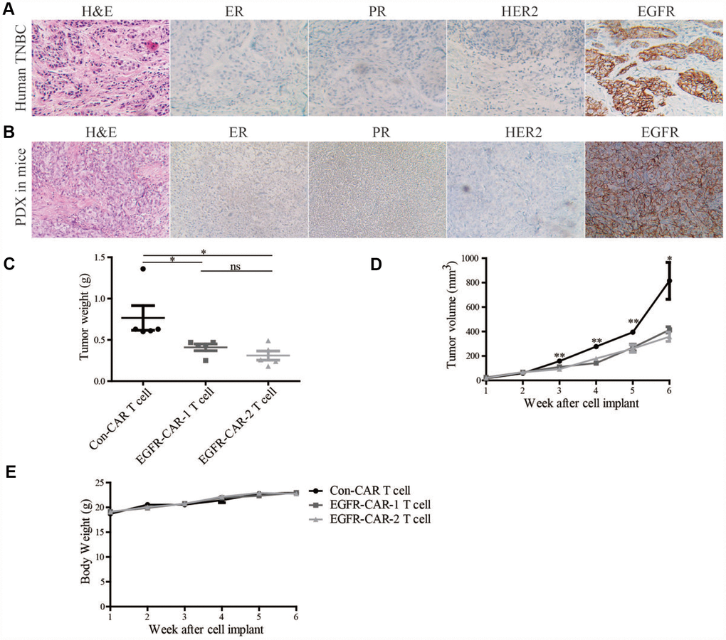EGFR-CAR-T cells inhibited high-EGFR-expressing TNBC tumor growth in PDX mouse model. ER, PR, HER2, and EGFR expression in (A) clinical breast cancer samples and (B) breast cancer tumors in PDX mice were assessed in immunohistochemical assays. Compared to con-CAR-T cells, EGFR-CAR-1 and EGFR-CAR-2 T cells decreased breast cancer (C) tumor weights and (D) tumor volumes but did not affect (E) body weights. Error bars represent means ± SEM. T-tests were used for statistical analysis; *p p 