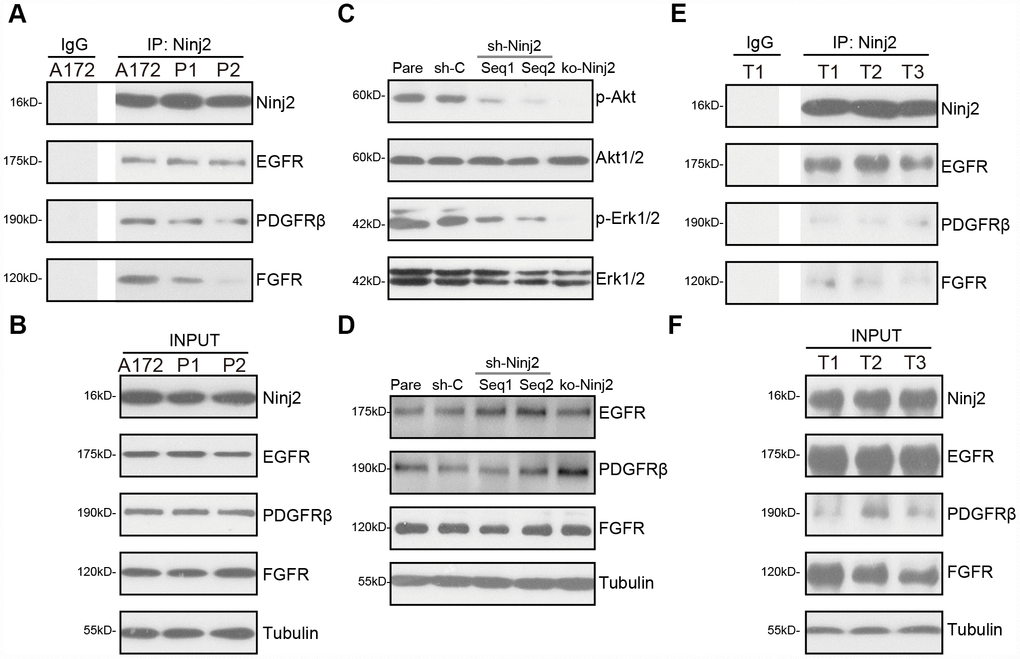 Ninj2 associates with multiple receptor tyrosine kinases, required for downstream Akt and Erk activation. In A172 cells and primary human glioma cells (“P1/P2”) the association between Ninj2 with RTKs (EGFR, PDGFRβ and FGFR) was tested by co-immunoprecipitation (“Co-IP”) assays (A); “INPUT” shows expression of the RTKs and Ninj2 in total cell lysates (B). A172 cells were transduced with lentiviral Ninj2 shRNAs (“sh-Ninj2”, two different sequences “Seq1/Seq2”), control shRNA (“sh-C”) or the CRISPR/Cas9 Ninj2 KO construct (“ko-Ninj2”), stable cells were established via puromycin selection; expression of listed proteins was tested by Western blotting (C and D); Fresh human glioma tissue lysates from three patients (“T1/2/3”) were subjected to the same Co-IP assay (E), “INPUT” shows expression of RTKs and Ninj2 in the tumor lysates (F). Experiments in this figure were repeated five times, and similar results were obtained.