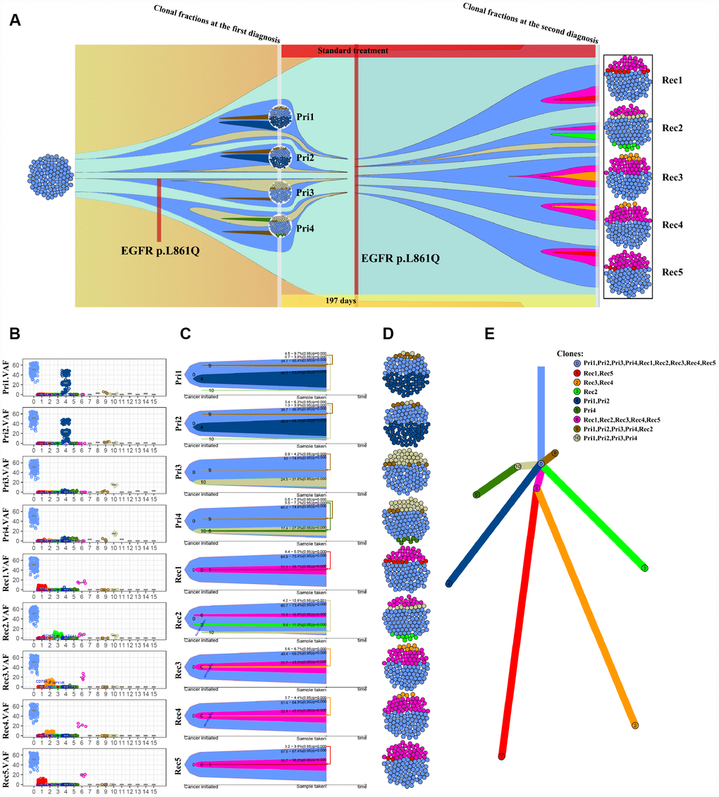 Analysis of the subclones and evolution of primary and recurrent GBM samples from patient NO. 05. (A) Four intra-tumor loci from the primary tumor and 5 intra-tumor loci from the recurrent tumor from the same patient were sequenced and analyzed. (B) VAF distribution of different subclone types at each intratumor locus. (C) A clonal evolution map of each intratumor locus. (D) Clonal structure distribution of each intratumor locus. (E) A tumorigenic chart of intratumor loci.