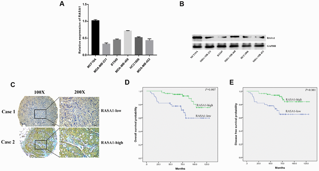 RASA1 is down-regulated and associated with poor prognosis of TNBC. (A) qRT-PCR detected mRNA expression of RASA1 in breast cancer cell lines;(B)Western blots detected RASA1 expression in breast cancer cell lines;(C) Representative IHC images of high and low RASA1 expression in TNBC tissues;(D, E)The effect of RASA1 expression on OS and DFS in patients with TNBC.