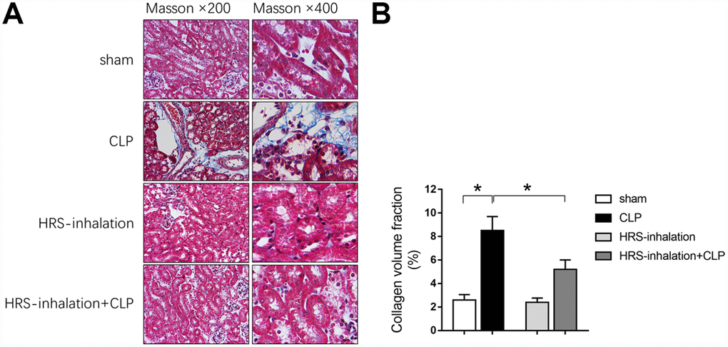 Aerosol inhalation of an HRS attenuated sepsis-induced renal fibrosis. (A) Masson’s Trichrome staining, where blue staining represents extracellular matrix deposition, suggesting fibrosis; (B) Collagen volume fraction ratio. n=6 per group. Data are shown as the mean ± SEM. In (B), significance was calculated by one-way ANOVA with Tukey’s post hoc test, *: P.