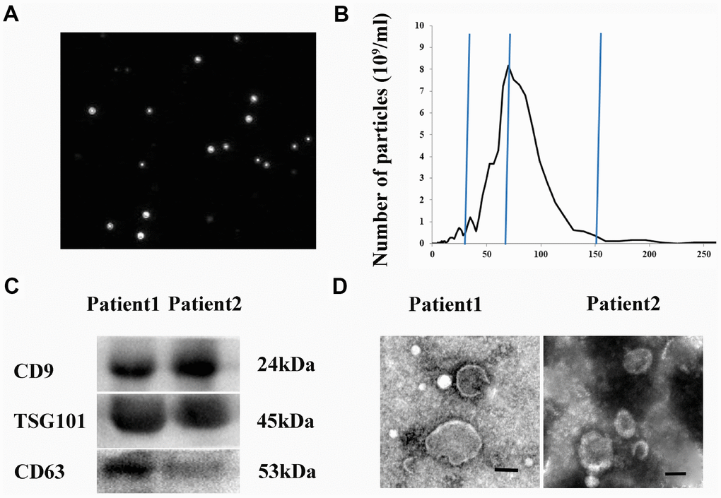 Isolation and characterization of hematoma-derived exosomes. (A) Representative images from NanoSight particle tracking analysis. (B) Size distribution of hematoma-derived exosomes. (C) Expression of CD9, CD63, and TSG101 in hematoma-derived exosomes. (D) Representative TEM image of exosomes. Scale bar: 100 nm.