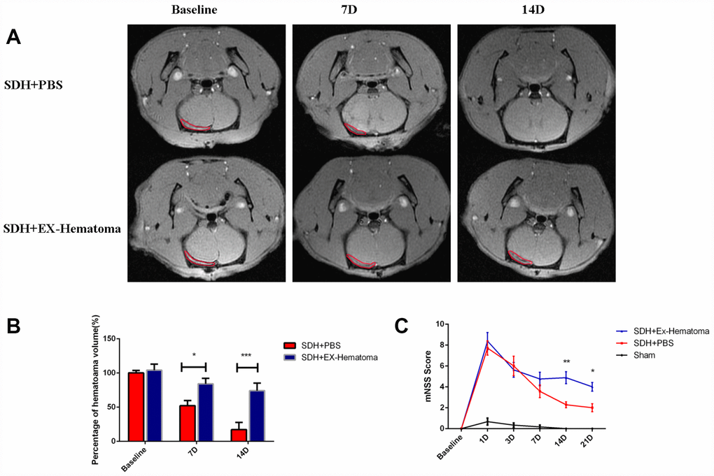 The effects of hematoma-derived exosomes on hematoma absorption and neurological function. (A) Representative MR images of SDH rats at baseline, and 7 and 14 days after injection. (B) Quantification of hematoma volume. No differences in hematoma volume were observed at baseline, while the EX-Hematoma group had higher hematoma volumes on days 7 and 14 compared to the PBS control group. (C) The EX-Hematoma group had higher mNSS on days 14 and 21. Values are shown as the mean ± SEM, Two-way ANOVA, *p 