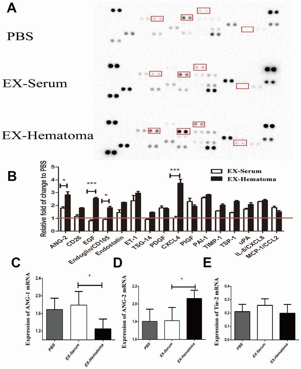The effects of hematoma-derived exosomes on angiogenic cytokine expression. (A) Representative images of the cytokine array. (B) Quantification of cytokine expression. ANG-2, EGF, Endoglin, and CXCL4 expression were higher in the EX-Hematoma compared to the EX-Serum group. (C–E) RT-PCR analysis of ANG-1, ANG-2, and Tie-2 mRNA expression following co-culture with exosomes. ANG-2 mRNA expression was higher, while ANG-1 expression was lower in the EX-Hematoma compared to the EX-Serum group. * p 