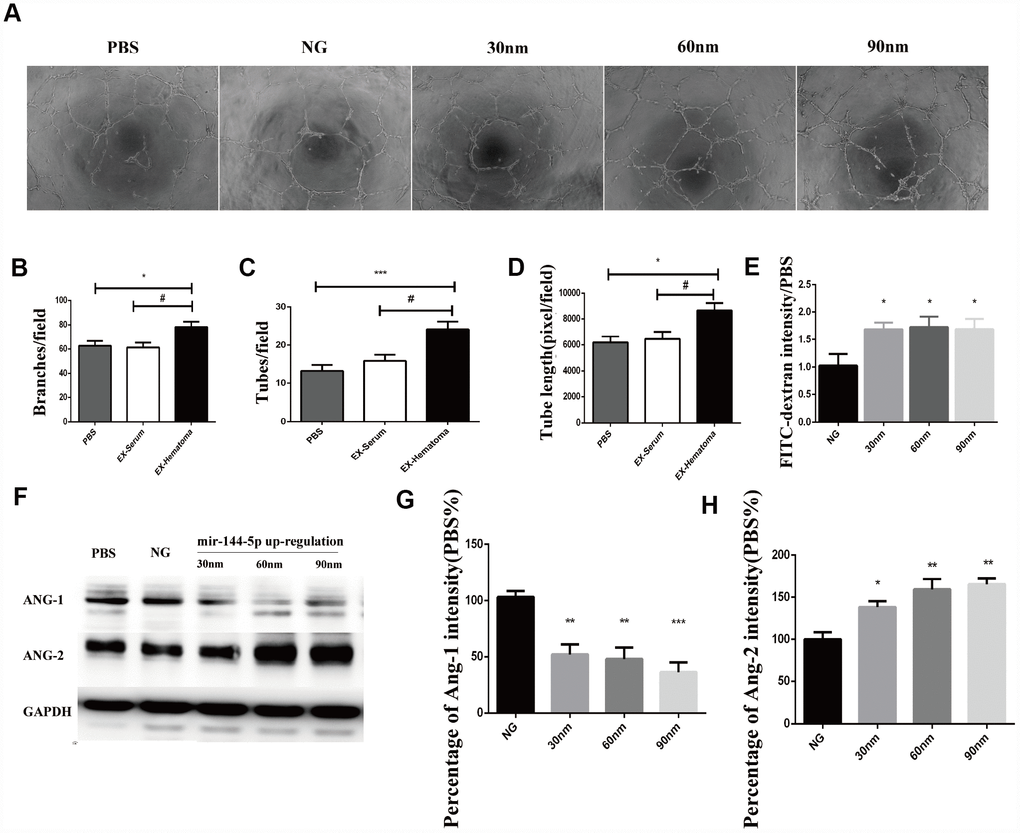 Over-expression of miR-144-5p promoted tube formation, increased cell permeability, increased ANG-2 expression, and decreased ANG-1 expression in HUVECs. (A) Representative images of tube formation. (B–D) Quantification of branches, tubes, and tube length. (E) Effects of miR-144-5p over-expression on the permeability of HUVEC monolayers to FITC-Dextran. (F) Representative images of western blots showing ANG-1 and ANG-2 expression. (G–H) Quantification of ANG-1 and ANG-2 expression.* p 