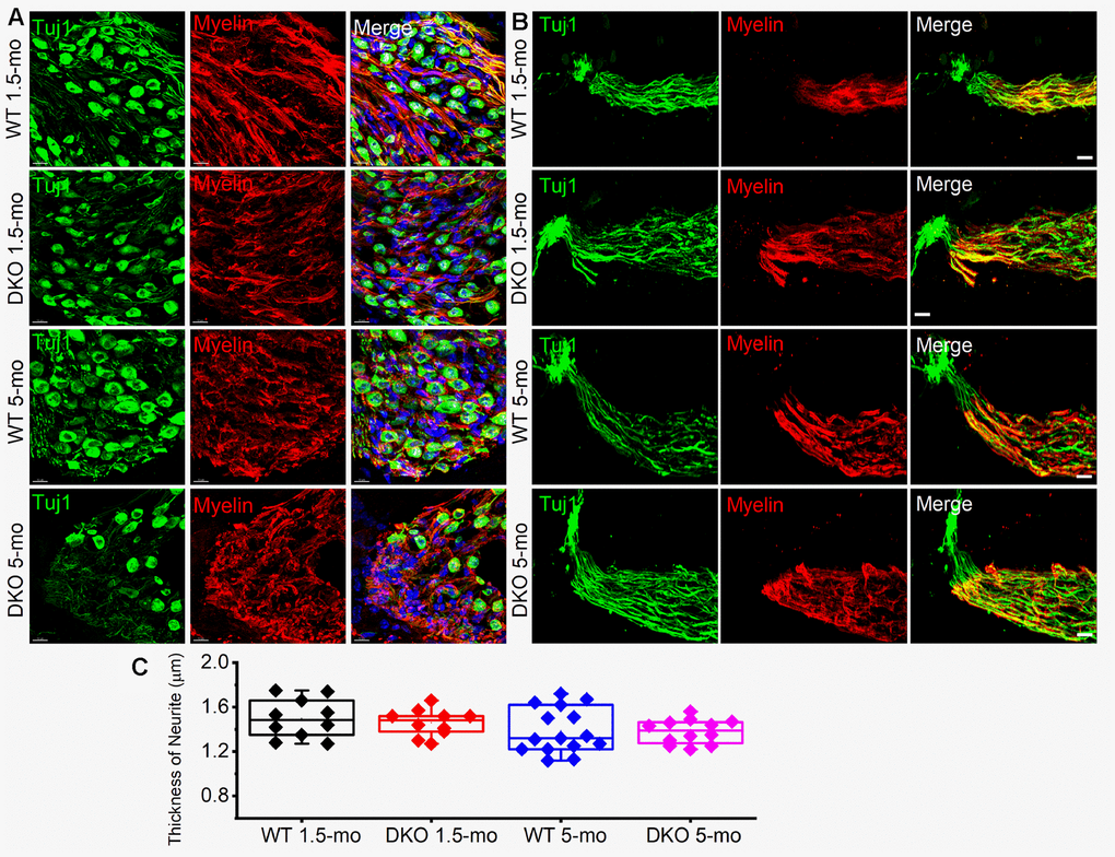 Myelin density and neurite thickness are unaltered in 1.5-5-old WT and DKO mice. (A) Sections of 1.5- and 5-mo-old WT and DKO spiral ganglion (SG) labeled with Tuj1 (green), and myelin (red) antibodies. Sections were obtained from the basal region of the cochlea. (B) Sections of 1.5 and 5-mo old WT and DKO peripheral neurites of SGN labeled as in (A). (C) Box plot of neurite thickness (diameter) at different age groups. Scale bar = 10 μm.