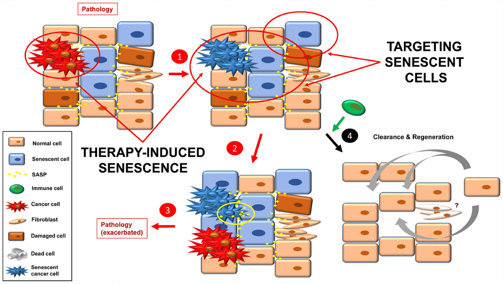 Inducing senescence in tumor cells will lead to an accumulation of senescence burden (1). The pro-inflammatory and pro-tumorigenic environment (more SASP factors) leads to exacerbation of the pathology (e.g. cancer relapse, fibrosis, inflammation) (2, 3). By targeting senescent cells with a combination of the approaches currently used, a better final scenario is possible (4). Fibrotic scarring may be treated by other means, or cured over time.
