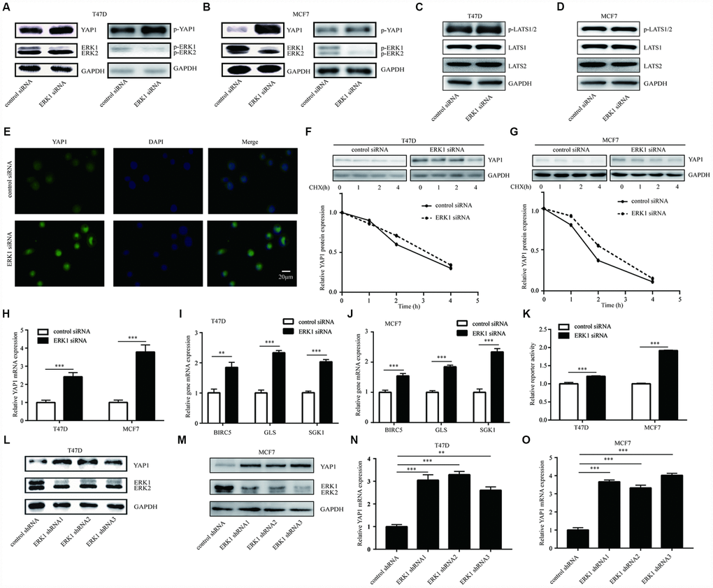 ERK1 repressed YAP1 signaling-related gene expression in breast cancer cells. (A) Western blotting showed that silencing of ERK1 increased YAP1 protein levels in T47D cells. (B) Western blotting showed that silencing of ERK1 increased YAP1 protein levels in MCF7 cells. (C) Western blotting showed that silencing of ERK1 did not change p-LATS1/2, LATS1 and LATS2 protein levels in T47D cells. (D) Western blotting showed that silencing of ERK1 did not change p-LATS1/2, LATS1 and LATS2 protein levels in MCF7 cells. (E) Immunofluorescence showed that ERK1 silencing increased YAP1 protein expression in T47D cells. (F) The CHX chase assay showed that the YAP1 protein stability was not altered upon silencing of ERK1 in T47D cells. (G) The CHX chase assay showed that the YAP1 protein stability was not altered upon silencing of ERK1 in MCF7 cells. (H) RT-qPCR showed that ERK1 silencing elevated YAP1 mRNA levels in T47D cells and MCF7 cells. (I) RT-qPCR showed that ERK1 silencing elevated mRNA levels of YAP1 downstream genes (BIRC5, GLS, SGK1) in T47D cells. (J) RT-qPCR showed that ERK1 silencing elevated mRNA levels of YAP1 downstream genes (BIRC5, GLS, SGK1) in MCF7 cells. (K) Knockdown of ERK1 increased GTIIC reporter activity in T47D cells and MCF7 cells. (L) Lentivirus mediated knockdown of ERK1 increased YAP1 protein expression in T47D cells. (M) Lentivirus mediated knockdown of ERK1 increased YAP1 protein expression in MCF7 cells. (N) Lentivirus mediated knockdown of ERK1 increased YAP1 mRNA expression in T47D cells. (O) Lentivirus mediated knockdown of ERK1 increased YAP1 mRNA expression in MCF7 cells. *, p