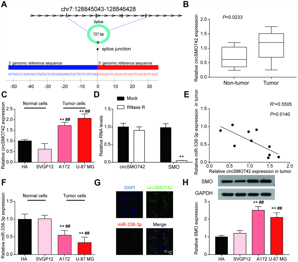CircSMO742 and miR-338-3p had an opposite expression in glioma. (A) The mosaic site sequence information of circSMO742. (B) Higher expression level of circSMO742 in tumor tissue than in non-tumor tissues in 10 tumor samples, PC) Higher level of circSMO742 expression in A172 and U-87 MG, measured with qRT-PCR. (D) RNase eliminated the SMO mRNA. (E) Negative correlation of miR-338-3p and circSMO742 in 10 tumor tissues, R2=0.5505, PF) lower level of miR-338-3p expression in A172 and U-87 MG, measured with qRT-PCR. (G) CircSMO742 was located in the cytoplasm. (H) Lower expression level of SMO proteins in A172 and U-87 MG, detected with western blot assay. *PPPPPP