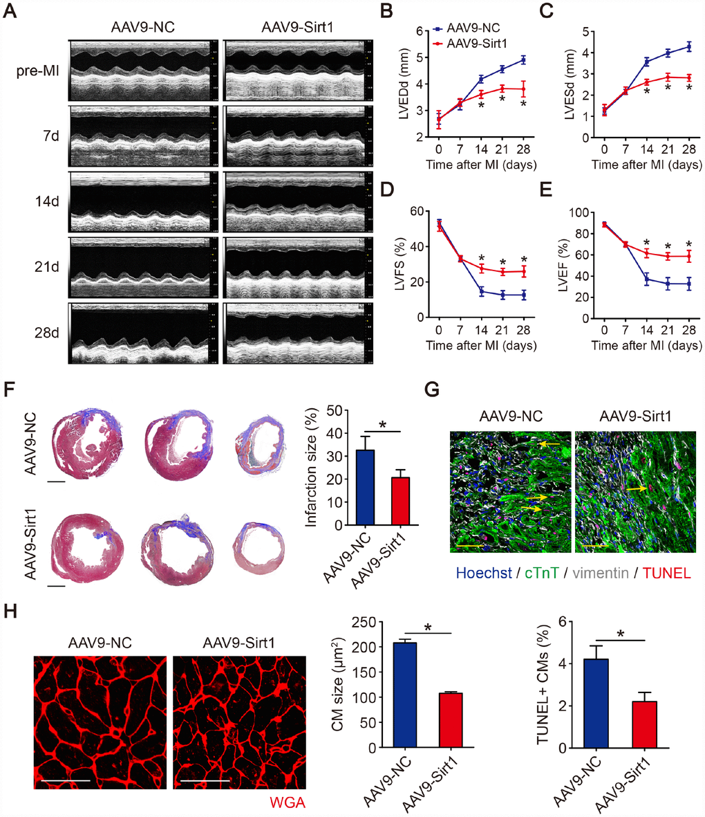 Sirt1 induces cardiac regeneration after MI in adult mice. (A–E) M-mode ultrasonic cardiography changes in mouse hearts, as detected by echocardiography in AAV9-NC and AAV9-Sirt1 adult mice pre-MI and 7, 14, 21, and 28 days after MI. Quantitative analyses were performed for LVEDd (B), LVESd (C), LVFS (D), and LVEF (E) (n=5). (F) Masson’s trichrome staining of serial ventricular sections in AAV9-NC and AAV9-Sirt1 adult mice 28 days after MI. Infarction size was quantified (n=5). Scale bar, 1mm. (G) Cell apoptosis was detected by TUNEL staining and TUNEL-positive CMs were quantified in AAV9-NC and AAV9-Sirt1 adult mice 28 days after MI. Scale bar, 20μm. Quantitative analyses are representative of fields from 5 mice per group. (H) WGA staining and quantitative analyses of CMs size in AAV9-NC and AAV9-Sirt1 adult mice 28 days after MI. Scale bar, 50 μm. Quantitative analyses are representative of fields from 5 mice per group. Statistical significance was calculated using a one-way ANOVA followed by LSD post hoc test in B-E and a two-tailed unpaired Student’s t-test in F-H. *p