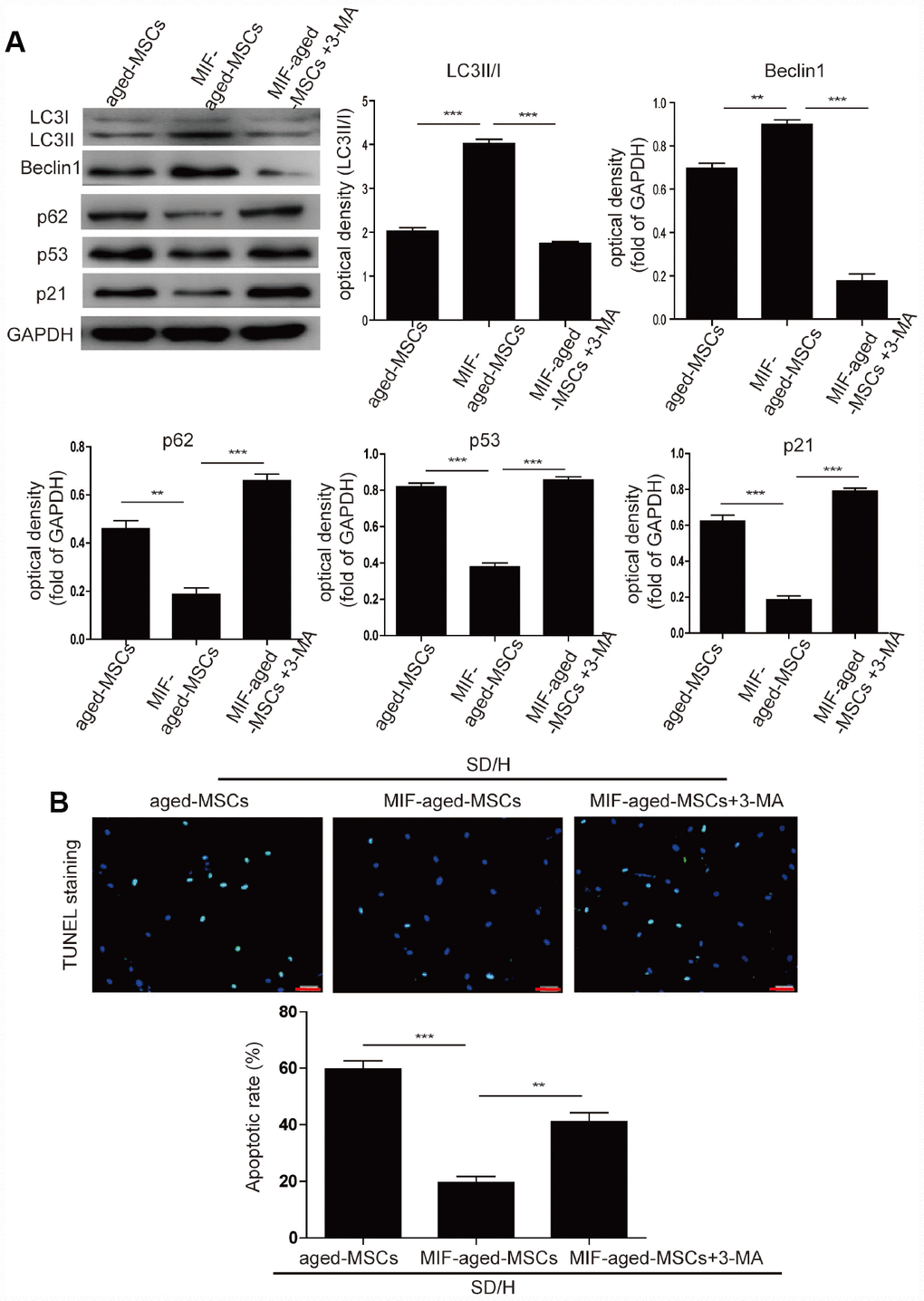 MIF rejuvenated aged MSCs by promoting autophagy. (A) Western blotting and quantitative analysis of LC3I/II, Beclin1, p62, p53 and p21 protein expression in aged MSCs and MIF-aged MSCs with or without 3-MA treatment. (B) Representative images of TUNEL staining and quantitative analysis of the apoptosis of aged MSCs and MIF-aged MSCs with or without 3-MA treatment under an SD/H challenge. Scale bar=100 μm. Data are expressed as the mean±SEM. n=3. **p
