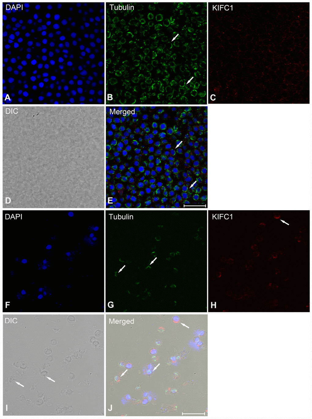 Immunofluorescent localization of KIFC1 and tubulin during post-spermiogenesis in the vas deferens and in mature sperm from spermatophore of P. japonicus. (A–E) Spermatid during post-spermiogenesis in the vas deferens. The signal of KIFC1 was very weak. The microtubules exhibited spindle morphology around the sperm nucleus (white arrows). (F–J) Mature sperm in spermatophore. KIFC1 and microtubules have completely separated localization in the mature sperm. From (J), it was clearly that KIFC1 was mainly localized at acrosome, while the microtubules distributed in the opposite side cytoplasm. Blue: DAPI, Green: tubulin, Red: KIFC1. Scale bar = 20μm.