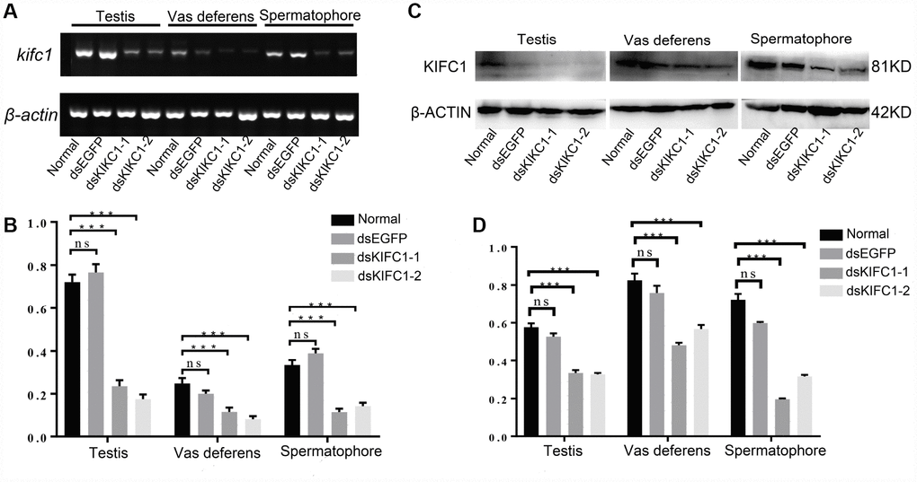 Knockdown efficiency of kifc1 by dsRNA injection in vivo. (A) Expression level of kifc1 mRNA was assayed by semi-quantitative RT-PCR analysis in the testis, vas deferens and spermatophore of P. japonicus. (B) A quantitative analysis of kifc1 mRNA expression in the testis, vas deferens and spermatophore was determined by Image J. (C) Expression level of KIFC1 protein was detected by Western blot in the testis, vas deferens and spermatophore of P. japonicus. (D) A quantitative analysis of KIFC1 protein expression in the testis, vas deferens and spermatophore was determined by Image J. β-actin was used as an internal control.