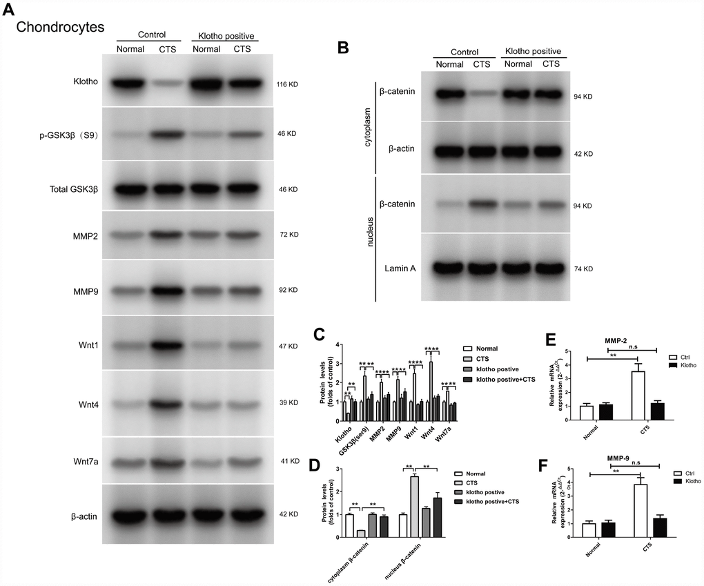 Klotho inhibits Wnt-mediated β-catenin activation and represses its target genes in vitro. Chondrocytes were transfected with empty vector or Klotho expression vector as indicated, followed by incubation with or without CTS(1 HZ) for 48 hours. Western blot (A, B) and quantitative data (C, D) for Wnt1, Wnt4 and Wnt7a in the cell supernatant and GSK3β, p-GSK3β, MMP2, MMP9 and active β-catenin are presented. Klotho abolished CTS-mediated Wnt actions. (E, F) RT-PCR was used to detect the expression of MMP-2 and MMP-9 mRNA in different groups. Results were obtained via the expression of three individual experiments performed in triplicate for each condition. *P 