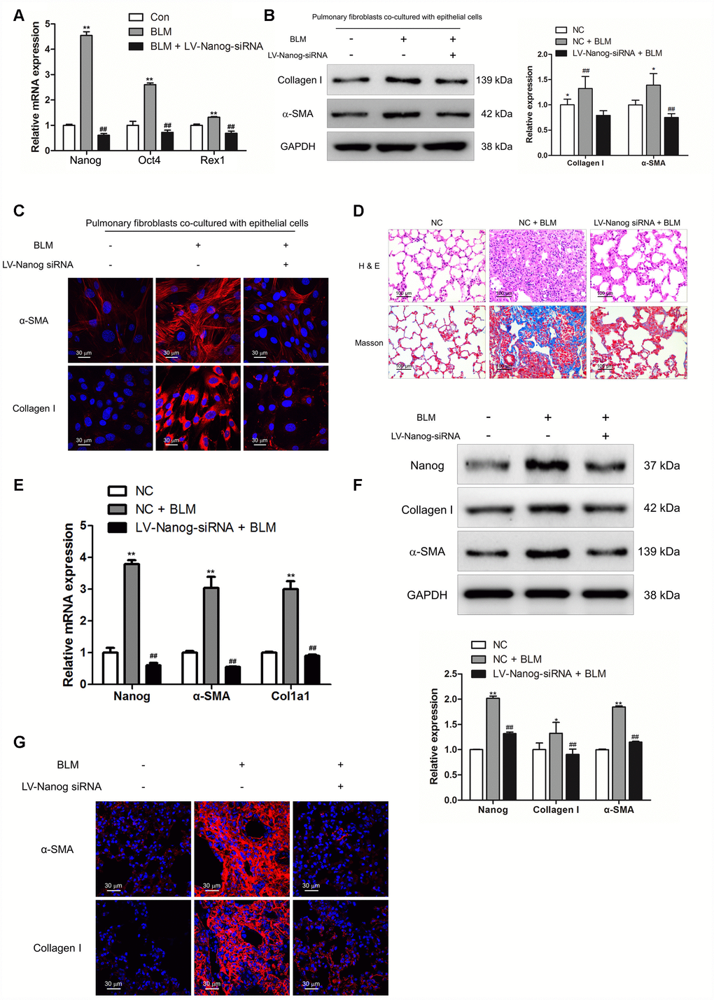 Nanog silencing could suppress pulmonary fibroblast activation and impair the development of pulmonary fibrosis. (A–C) Pulmonary fibroblasts were transfected with LV-Nanog-siRNA and co-cultured with MLE-12 cells as in Figure 3D. (A) The mRNA levels of Nanog, Oct4 and Rex1 were measured by Q-PCR, ** P B) The protein levels of collagen I and α-SMA were determined by Western blot. The expression levels were quantified with ImageJ (n = 3). GAPDH was used as a loading control, *P C) The expression of collagen I and α-SMA were further examined by immunofluorescence staining. (D–G) Mice were intratracheally injected with 5 × 108 TU/ml LV-Nanog-siRNA or negative control (NC) 7 days after administration of BLM. Mice were sacrificed on day 21 after BLM instillation. (D) Pulmonary fibrosis was determined by haematoxylin and eosin (H&E) staining and collagen I was revealed by Sirius Red/Fast Green staining. (E) The mRNA levels of Nanog, α-SMA and collagen I were determined by Q-PCR, ** P F) The protein levels of Nanog, collagen I and α-SMA were measured by Western blot. The expression levels were quantified with ImageJ (n = 3). GAPDH was used as a loading control, *P G) The expression of α-SMA and collagen I were further confirmed by immunofluorescence staining.