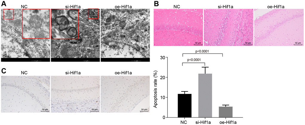 The pathological changes of hippocampal neurons in the MPTP-lesioned mouse model of PD. (A) The ultrastructure of hippocampal neurons treated with si-Hif1a or oe-Hif1a to electron microscopy. (B) The pathological changes of hippocampal neurons treated with si-Hif1a or oe-Hif1a revealed by HE staining (scale bar = 50 μm). (C) The apoptosis of hippocampal neurons treated with si-Hif1a or oe-Hif1a detected by TUNEL staining (scale bar = 50 μm). * p vs. the NC group (MPTP-lesioned mice treated with NC plasmids). N = 10.
