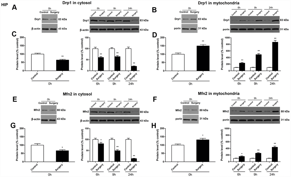 Surgery/Anesthesia changed the expression of Drp1 and Mfn2 in the cytosolic fraction and in the mitochondrial fraction of the hippocampus in aged mice at 0, 6, 9, and 24 hours postoperatively. The expression of Drp1 and Mfn2 was estimated using western blotting analysis of fresh cytosolic and mitochondrial fractions of the hippocampus obtained from mice at 0, 6, 9, and 24 hours after Surgery/Anesthesia or control treatment. As compared to control condition in mice, Surgery/Anesthesia decreased Drp1 expression in the cytosolic fraction (A and C) and increased Drp1 expression in the mitochondrial fraction (B and D) of homogenates of hippocampal tissue. When compared to the control condition in mice, Surgery/Anesthesia significantly decreased the expression of Mfn2 in the cytosolic fraction (E and G) and increased Mfn2 level in the mitochondrial fraction (F and H) of homogenates of hippocampus tissue at 0, 6, 9, and 24 hours postoperatively. The data are plotted as the mean ± standard error of the mean for each group (n = 6). *p **p 