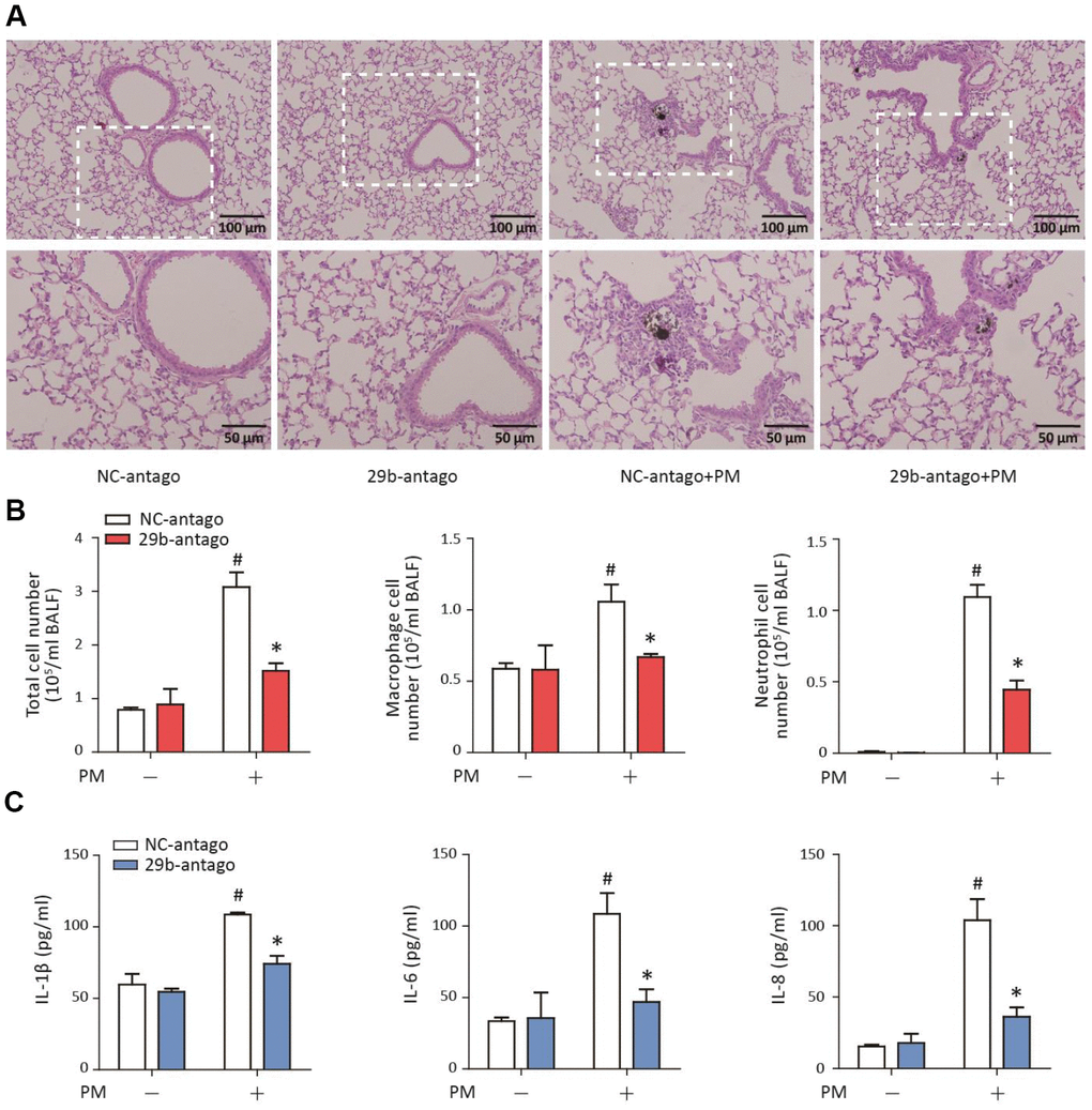 MiR-29b-3p inhibition attenuated the PM-induced acute lung inflammatory responses in vivo. The acute PM-exposed mouse model was constructed and miR-29b-3p antagomirs (29b-antago) or negative control antagomirs (NC-antago) were delivered via the tail vein of mice 24 h prior to the first PM exposure. (A) The histopathologic analysis of acute inflammatory responses in lung tissue of mice using H&E staining. (B) The numbers of total cells, macrophages and neutrophils in the BALF of mice were counted. (C) The concentrations of IL-1β, IL-6, and IL-8 in the BALF of mice were measured by ELISA. Values represent mean ± SEM; *, P