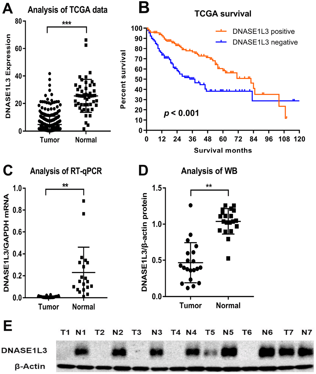 Comparison of DNASE1L3 expression level between HCC and adjacent normal tissues. Comparison of mRNA levels of DNASE1L3 between HCC tissues and paired normal tissues (A) and survival difference by mRNA levels (B) in the TCGA database and validation of DNASE1L3 expression level in mRNA (C) and protein level (D and E).