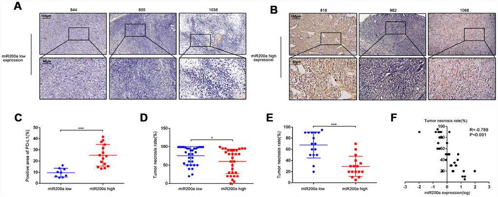 High expression of miR-200a predicts the poor response to chemotherapy. (A–C) Immunohistochemical staining analysis of PD-L1 expression in samples of osteosarcoma patients. The quantification of immunohistochemical staining was based on its positive area. Scale bar represents 50μm and 100μm separately. (D) Comparison of TNR in biopsy tissue of 62 osteosarcoma patients acquired from the GEO database (GSE39058-GPL15762). Divided them into two groups according to miR-200a expression. (E) Comparison of TNR in resection tissues of 32 osteosarcoma patients. Divided them into two groups according to miR-200a expression. (F) Correlation analysis between miR-200a and TNR in resection tissues of 32 osteosarcoma patients. The expression of miR-200a was log-transformed. *P