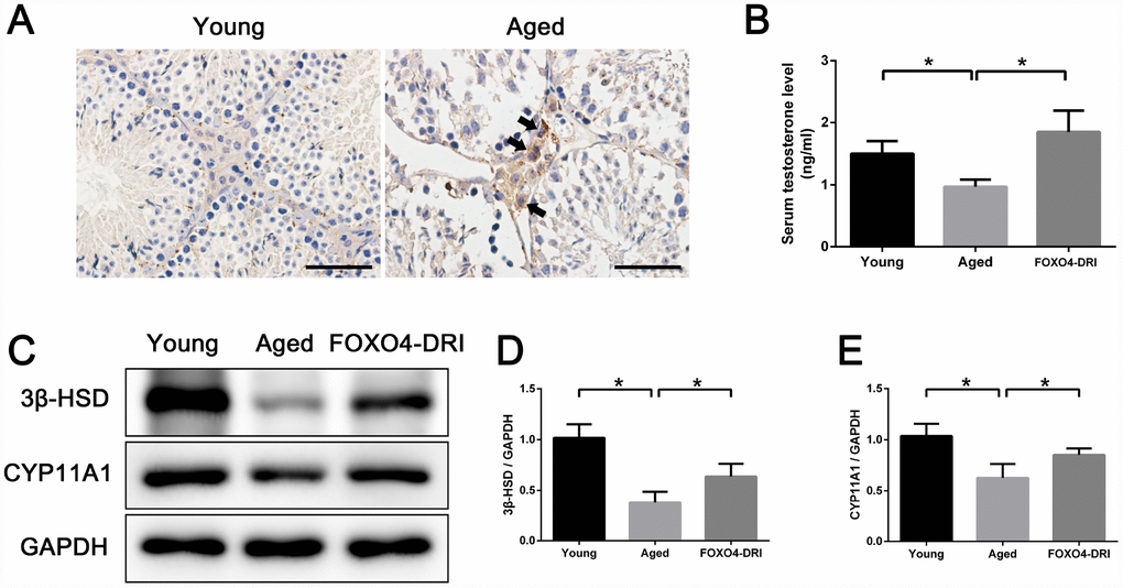 FOXO4-DRI alleviates testosterone secretion insufficiency in naturally aged mice. (A) Immunohistochemical staining showing that FOXO4 was rarely expressed in young (3 months of age) mice testes, but expressed typically in the Leydig cells of naturally aged (20-24 months of age) mice. In aged mice testes, FOXO4 was predominantly expressed in cytoplasm and showed nuclear localization in some Leydig cells (arrows). Scale bar: 50 μm. (B) Serum testosterone levels in naturally aged (20-24 months of age) male mice are lower than in young adult (3 months of age) male mice, but are significantly increased 30 days after FOXO4-DRI treatment (intraperitoneal injection of 5 mg/kg every other day for three administrations). (C–E) Western blots revealing that FOXO4-DRI treatment increases protein levels of the testosterone synthesis-related proteins 3β-HSD and CYP11A1 in the testes of aged mice. Data depict the mean ± SD; n=6. *P