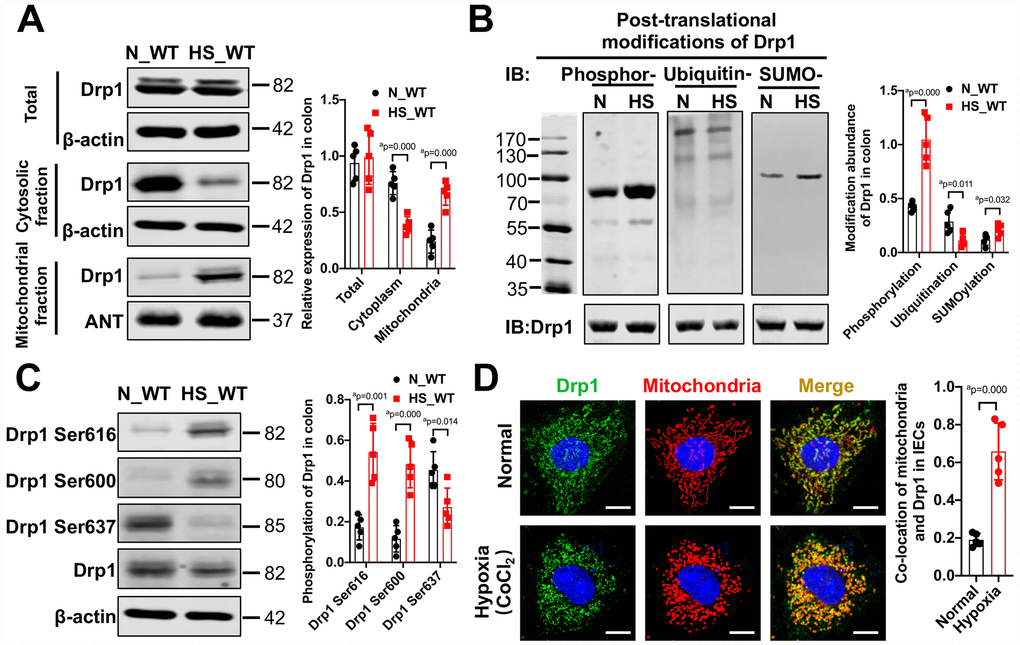 The activation and mitochondrial translocation of Drp1 in IECs after shock or hypoxia. (A) The mitochondrial translocation of Drp1 after hemorrhagic shock in colon tissues. N