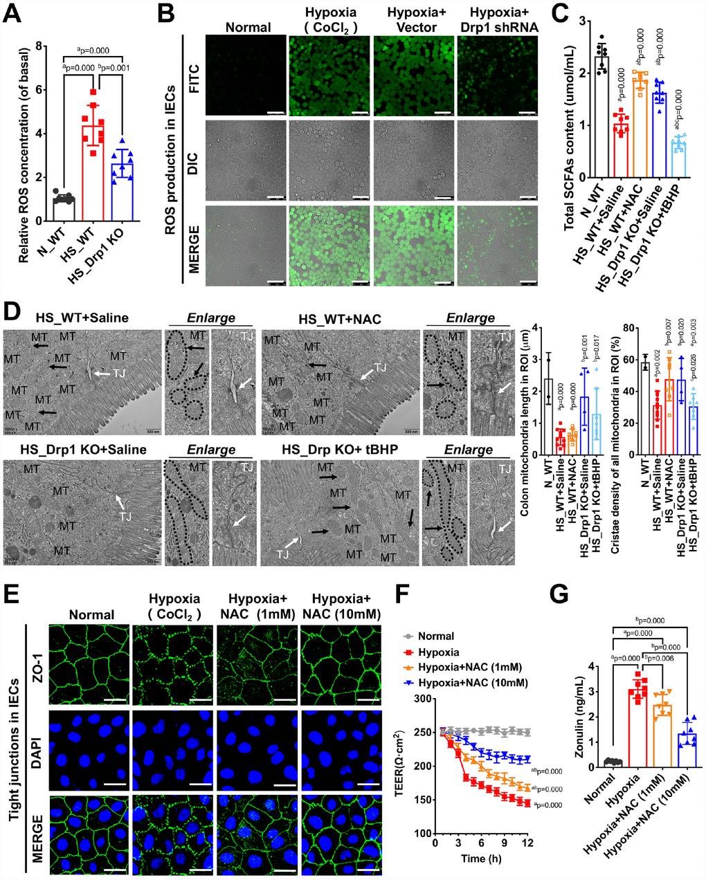Drp1-induced ROS accumulation is involved in the regulation of gut microbiome composition and intestinal barrier function after shock or hypoxia. (A) Relative ROS concentration in colon tissues of each group (8 mice/ group). (B) The ROS fluorescence intensity of hypoxia-treated IECs after Drp1 shRNA (Bar, 50μm) (C) The content of total SCFAs after ROS intervention (8 mice/ group). (D) Mitochondrial morphology and tight junction of IECs after ROS intervention observed by electron microscopy. MT, mitochondria (black arrows refer to vacuolated cristae structure); TJ, tight junctions (white arrows). The boundaries of mitochondria are depicted and the lengths as well as cristae density of all mitochondria in ROI (region of interest) are calculated by Image J software. The mitochondrial number in ROI: 2 in N