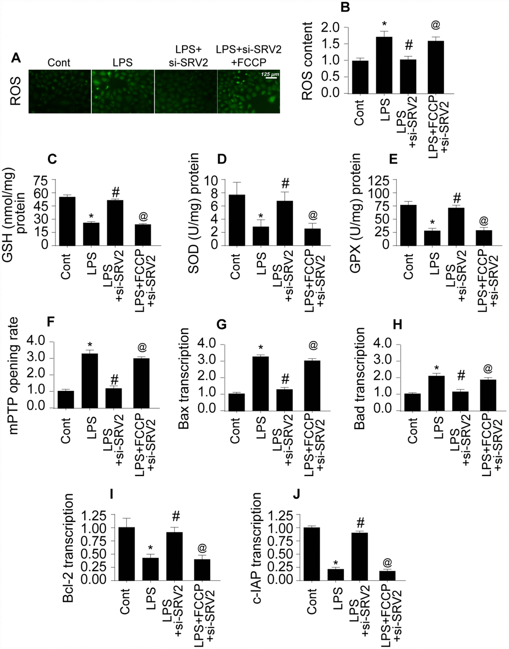 SRV2-induced mitochondrial fission promotes mitochondrial damage. (A–B) An ROS probe was used to detect ROS production in cardiomyocytes after transfection of siRNA against SRV2 and addition of FCCP to the culture medium. (C–E) SOD, GSH, and GPX levels were measured via ELISA in cardiomyocytes after SRV2 siRNA transfection and FCCP treatment. (F) mPTP opening was determined via ELISA in cardiomyocytes after SRV2 siRNA transfection and FCCP treatment. (G–J) After treatment, RNA was isolated from LPS-treated cardiomyocytes and qPCR was performed to analyze Bcl2, Bad, Bax, and c-IAP transcript levels after SRV2 siRNA transfection and FCCP treatment. *p