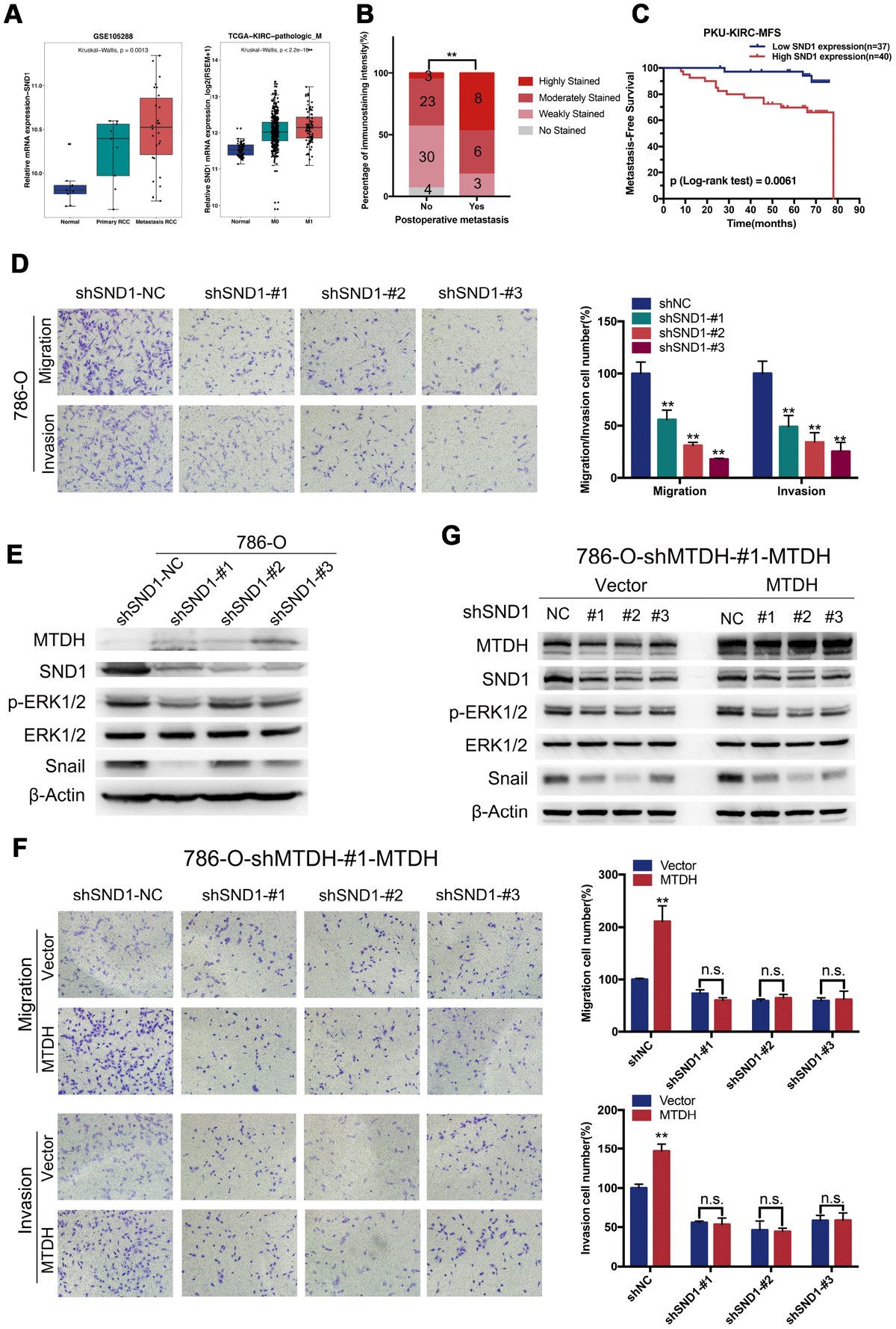 MTDH Promotes Metastasis Of Clear Cell Renal Cell Carcinoma By ...