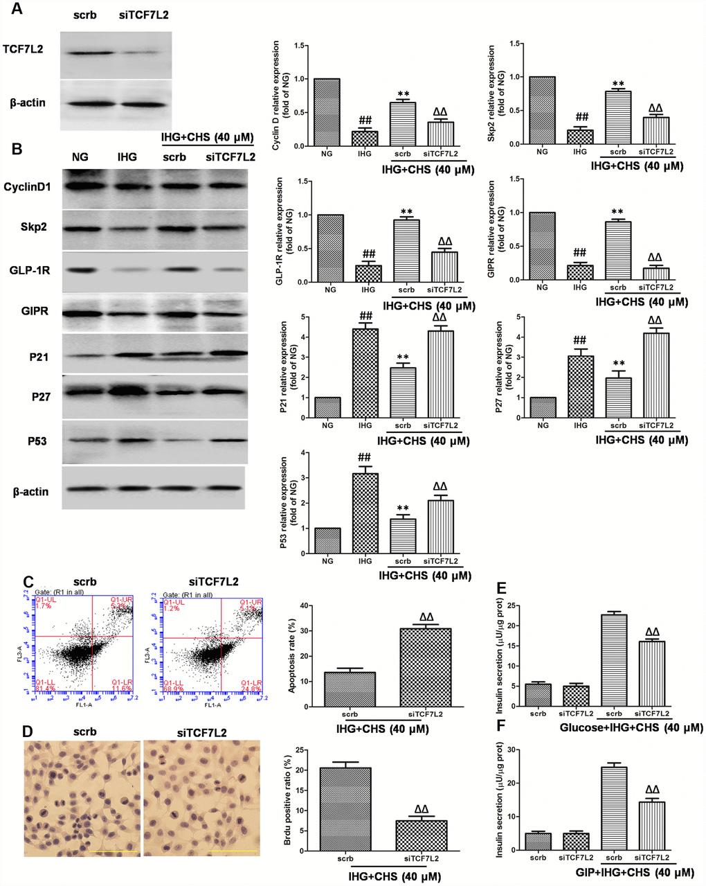 Effects of CHS might through TCF7L2 pathway. (A) The protein expression of TCF7L2 after siRNA transfection target TCF7L2. (B) The protein expression levels of TCF7L2 downstream proteins after inhibition of TCF7L2 by TCF7L2 siRNA. (C) The apoptosis rate of βTC3 cell was measured by flow cytometry after inhibition of TCF7L2 by TCF7L2 siRNA. (D) The BrdU immunohistochemical staining was performed after inhibition of TCF7L2 by TCF7L2 siRNA. (E) The effects of siTCF7L2 on the glucose induced insulin secretion. (F) The effects of siTCF7L2 on the GLP-1 induced insulin secretion. Data are representative of three independent experiments. ##P**PΔΔP