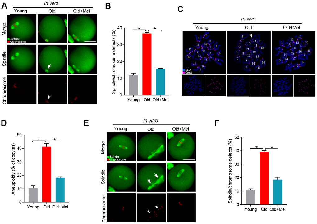 Effects of melatonin administration on meiotic apparatus in aged oocyte. (A) MII oocytes from young (n=90), old (n=88) and old mice treated with melatonin (old+Mel, n=80) were stained with α-tubulin to visualize spindle (green) and counterstained with propidium iodide to visualize chromosomes (red). Representative confocal sections are shown. Arrows indicate the spindle defects and arrowheads point to the misaligned chromosomes. (B) Quantification of young, old and old+Mel oocytes with abnormal spindle and chromosomes. (C) Chromosome spreading of young, old and old+Mel MII oocytes with aneuploidy. Chromosomes were stained with Hoechst 33342 (blue), and kinetochores were labeled with CREST (purple). (D) Histogram showing the incidence of aneuploidy in young (n=82), old (n=57) and old+Mel (n=53) oocytes. (E) Young and old oocytes in vitro cultured with or without melatonin were processed to evaluate meiotic apparatus. Young, old, and old+Mel oocytes were stained with α-tubulin to visualize spindle (green) and counterstained with propidium iodide to visualize chromosomes (red). Representative confocal sections are shown. Arrow indicates the disorganized spindle and arrowhead indicates the misaligned chromosomes. (F) Quantification of young (n=131), old (n=78) and old+Mel (n=95) oocytes with abnormal spindle/chromosomes. Data are expressed as mean percentage ± SD from three independent experiments. *P