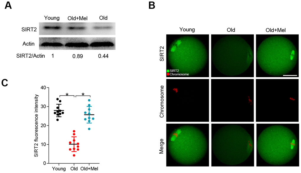 Effects of melatonin administration on SIRT2 expression in oocytes from old mice. (A) Western blot analysis shows the SIRT2 expression in GV oocytes from young, old and old+Mel mice. Actin served as a loading control. Band intensity was calculated using ImageJ software. (B) Representative confocal images of young, old and old+Mel MII oocytes stained with SIRT2 antibody (green) and counterstained with propidium iodide (red) for chromosomes. (C) Quantification of the relative fluorescence intensity of SIRT2 in oocytes in (B). Each data point represents an oocyte (n=10 for each group). *P