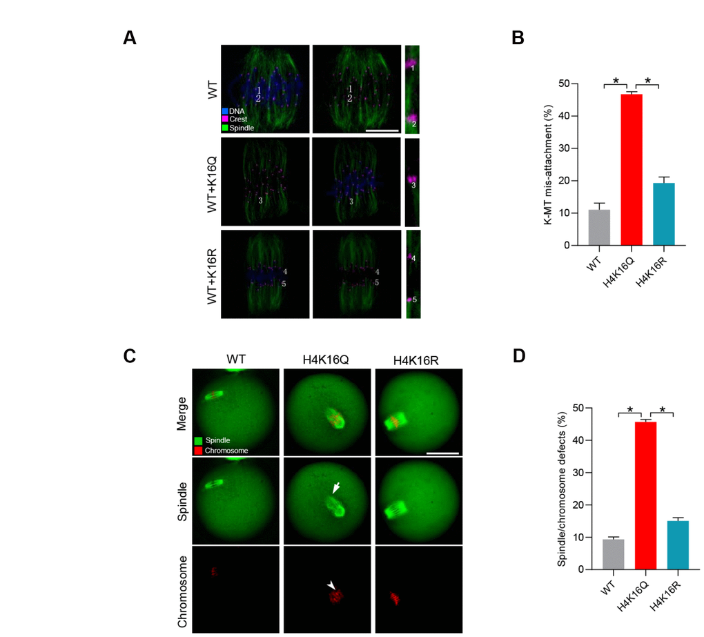 Effects of H4K16 acetylation on kinetochore–microtubule attachment and meiotic apparatus in mouse oocytes. (A) H4K16 wild-type (WT) and mutant-injected oocytes at metaphase stage were labeled with α-tubulin antibody to visualize spindle (green), CREST to detect kinetochore (purple), and co-stained with Hoechst 33342 for chromosomes (blue). Representative confocal sections are shown. Scale bars: 5 μm. Lost attachments were frequently detected in oocytes injected with H4K16Q mutant. (B) Quantitative analysis of K-MT mis-attachments in WT and H4K16 mutant-injected oocytes. Data are expressed as mean percentage ± SD from three independent experiments in which approximately 30 oocytes were analyzed. (C) WT and H4K16 mutant-injected oocytes were stained with α-tubulin antibody to visualize spindle (green) and counterstained with propidium iodide to visualize chromosomes (red). Representative confocal sections are shown. Scale bars: 50 μm. (D) Quantification of WT and H4K16 mutant-injected oocytes with spindle/chromosome defects. Data are expressed as mean percentage ± SD from three independent experiments in which around 115 oocytes were analyzed. *P