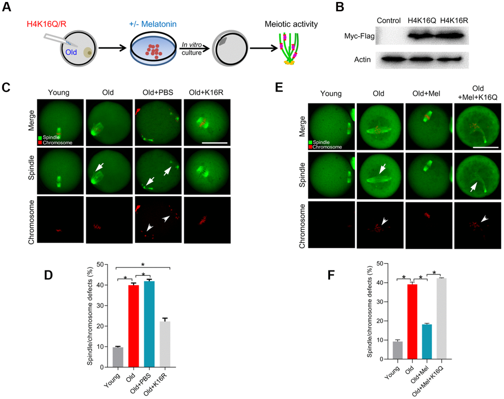 Overexpression of H4K16R mutant ameliorates the maternal age-associated meiotic defects in mouse oocytes. (A) Schematic illustration of the experimental protocol to check whether H4K16 acetylation mediates the effects of melatonin on the quality of aged oocyte. (B) Western blotting showing that two mutant H4K16 proteins were expressed to the similar extent. (C) Young, old, old+PBS and old+H4K16R oocytes were stained with α-tubulin to visualize spindle (green) and counterstained with propidium iodide to visualize chromosomes (red). Representative confocal sections are shown. Arrowheads indicate the misaligned chromosomes and arrows indicate the abnormal spindles. (D) Quantification of young, old, old+PBS and old+H4K16R oocytes with spindle/chromosome defects. (E) Young, old, old+Mel and old+Mel+H4K16Q oocytes were stained with α-tubulin to visualize spindle (green) and counterstained with propidium iodide to visualize chromosomes (red). Representative confocal sections are shown. Arrowheads indicate the misaligned chromosomes and arrows indicate the abnormal spindles. (F) Quantification of young, old, old+Mel and old+Mel+H4K16Q oocytes with spindle/chromosome defects. Data are expressed as mean percentage ± SD from three independent experiments in which at least 100 oocytes were analyzed. *P
