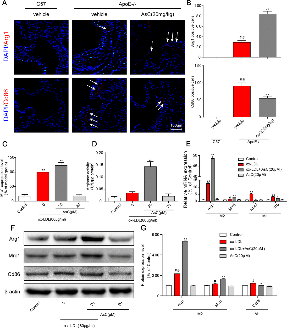 Araloside C attenuates atherosclerosis by modulating macrophage ...