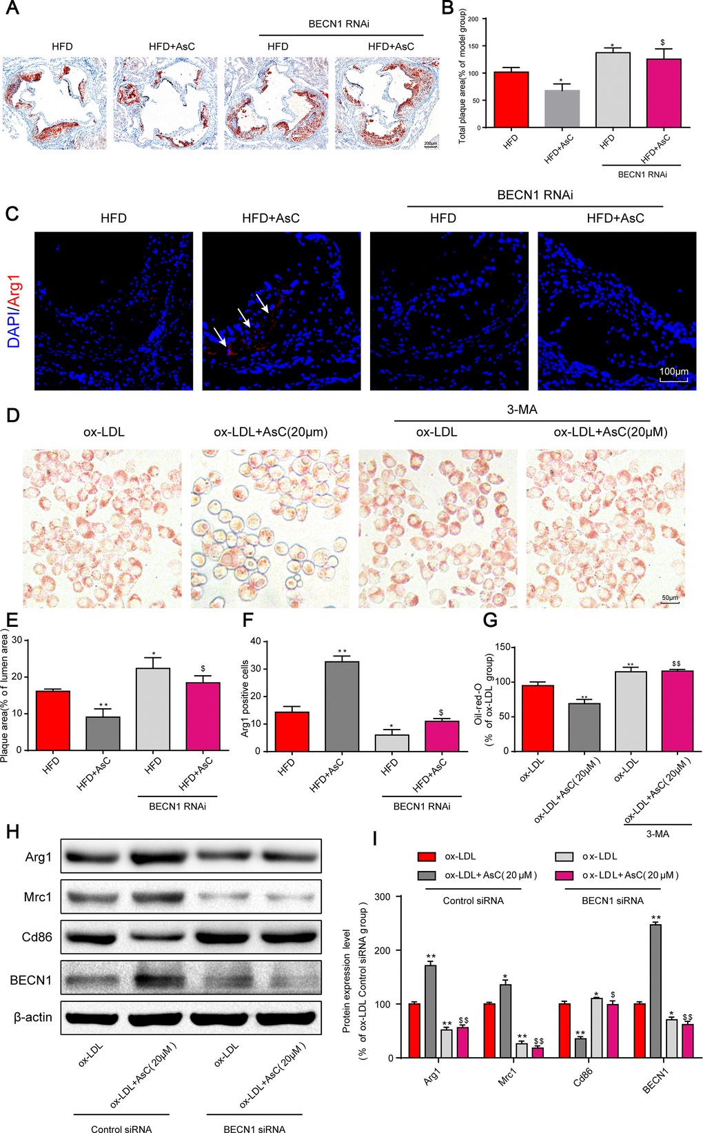 Autophagy inhibition abolished AsC-mediated antiatherosclerotic effects and macrophage polarization. All mice were fed a HFD in the presence or absence of AsC (20 mg·kg-1·day-1, i.g.) for 4 weeks. In the in vitro assay, RAW264.7 cells were pretreated with 3-MA (5 mM) for 2 h, treated with AsC (20 μM) for 12 h, and then exposed to ox-LDL for another 24 h. (A) Representative images of oil red O staining of the aortic root. (B) Quantification of the total plaque area. (C) Dual immunofluorescence staining forArg1 (red) and DAPI (blue) in lesions in the aortic root. (D) Representative images of oil red O staining of ox-LDL-treated RAW264.7 cells. (E) The percentage of plaque area relative to lumen area. (F) Quantification of relative fluorescence intensity. (G) Quantification of oil red O staining, as detected by a microplate reader. (H) Representative photographs of Arg1, Mrc1, Cd86 and BECN1 expression, as evaluated by western blot analysis. (I) Statistical results of Mrc1, Cd86 and Arg1 expression levels compared with those in the ox-LDL-treated group. The data are presented as the means ± SDs (n = 5). *P **P vs. the model group; $P $$P vs. the ox-LDL and AsC group.