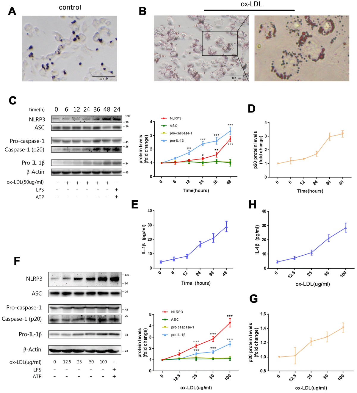 K63 ubiquitin chains target NLRP3 inflammasome for autophagic ...