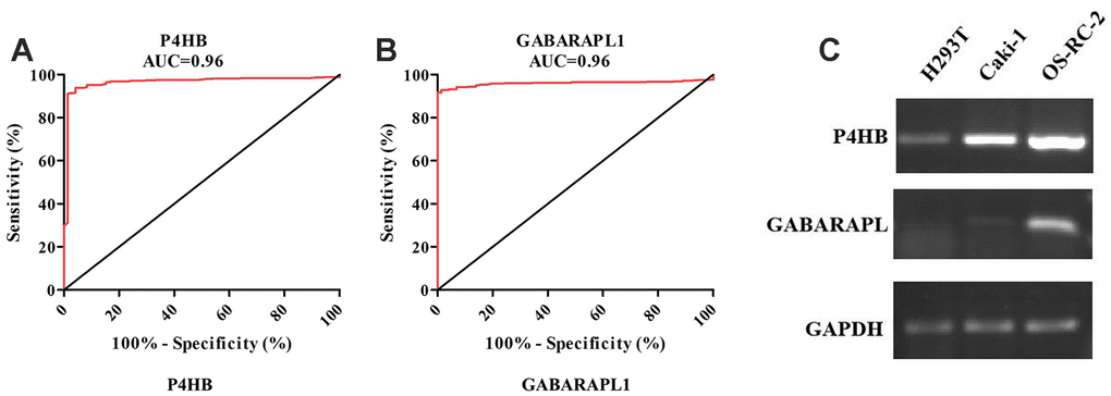 ROC analysis of P4HB and GABRAPL1 never related to KIRC diagnosis showing a very high ability to discriminate controls from KIRC samples validated in TCGA (A and B). The AUC is plotted as sensitivity% vs 100-specifificity%. The calculated AUC is reported in each case. The p value is P4HB and GABARAPL1 mRNA expression level in H293T cell (normal kidney), OS-RC-2 and Caki-1 cell (cancer cells) by RT-PCR (C). GAPDH gene was used as the internal control. P4HB expression in cancer cells is clearly higher than normal kidney cell, while GABARAPL1 expression in cancer cells is clearly lower than normal kidney cell.