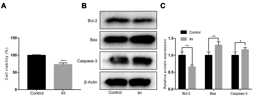 IH inhibits cell viability in HUVECs. (A) Cell viability by a Cell Counting Kit-8. (B, C) Western blotting assays for Bcl-2, Bax, and Caspase-3 protein levels. β-Actin was served as internal control. IH: intermittent hypoxia; n = 3. (Data are presented as the mean ± SD of three independent experiments. *P 