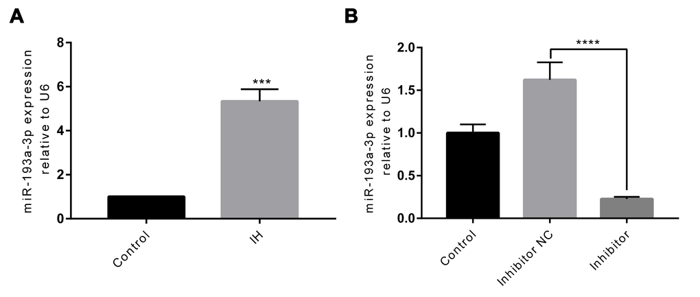 IH induces upregulation of miR-193a-3p, and miR-193a-3p is inhibited in HUVECs after transfection. (A) miR-193a-3p expression was measured by RT-qPCR. (B) Cells were transfected with miR-193a-3p inhibitor, and negative control. Relative miR-193a-3p expression was normalized to U6. IH: intermittent hypoxia; n = 3. (Data are presented as the mean ± SD of three independent experiments. ***P 