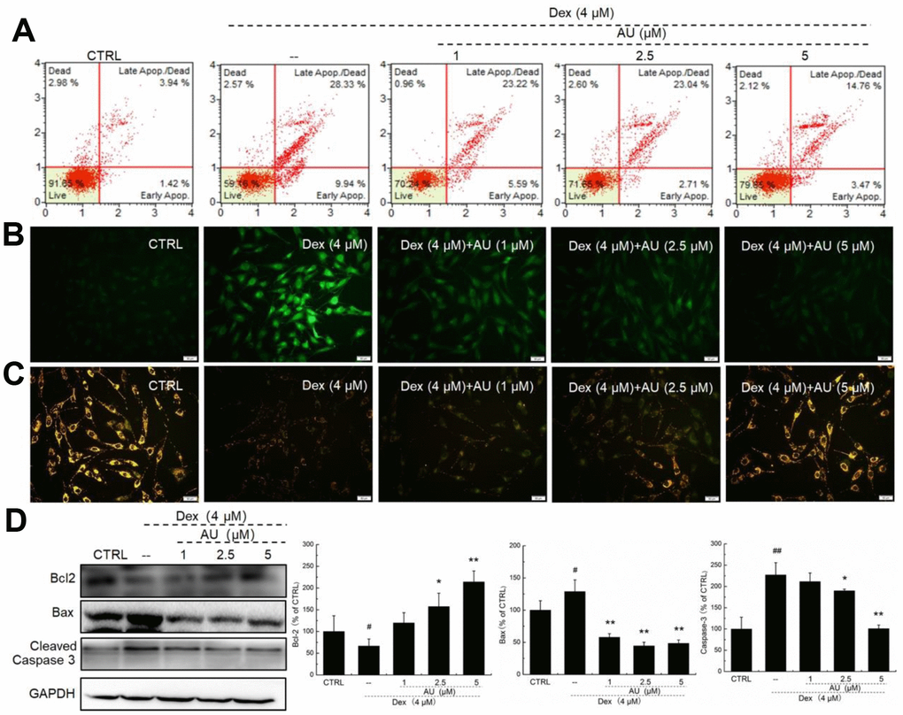 AU protected MG63 cells against Dex damage. (A) AU reduced the apoptosis rate of MG63 cells caused by Dex after 24 h incubation. (B) AU suppressed the over-accumulation of ROS in MG63 cells caused by Dex after 24 h incubation. (C) AU inhibited the dissipation of MMP in MG63 cells caused by Dex. (D) AU enhanced the expression levels of Bcl-2, and reduced the expression levels of Bax and cleaved caspase-3 in MG63 cells exposed to Dex. The quantification data of the expression levels of Bcl2, casepase3 and Bax were normalized by corresponding GAPDH. Data are expressed as mean ± S.D. (n=6) and analyzed using a one-way ANOVA. # PPvs. control cells, *PPvs. Dex-exposed cells.