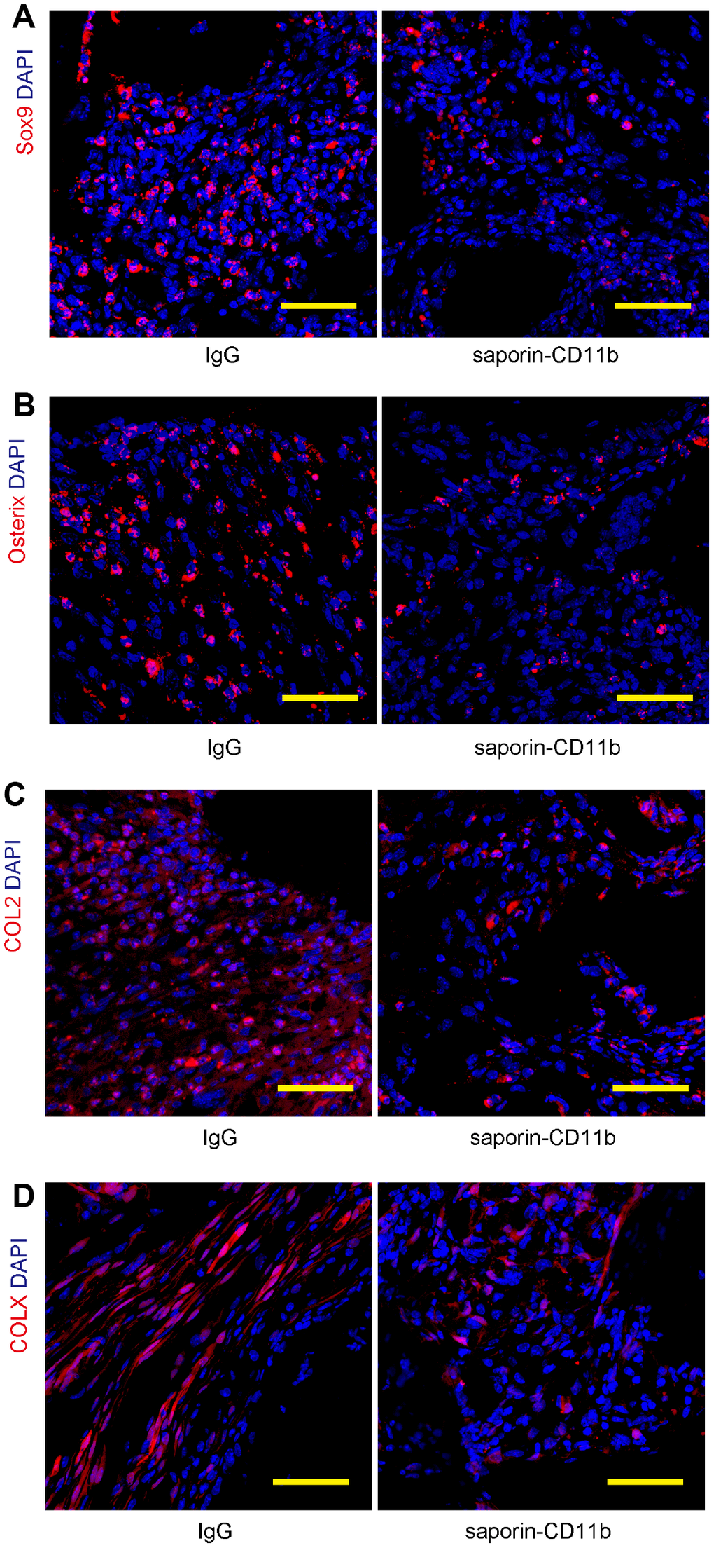 Macrophage depletion decreases regeneration-associated proteins. (A–D) Regeneration of the bone was assessed by examination of 4 regenerative markers, Sox9 (A) Osterix (B), COL2 (C) and COL X (D), by immunohistochemistry. N=8. Scale bars are 50μM.