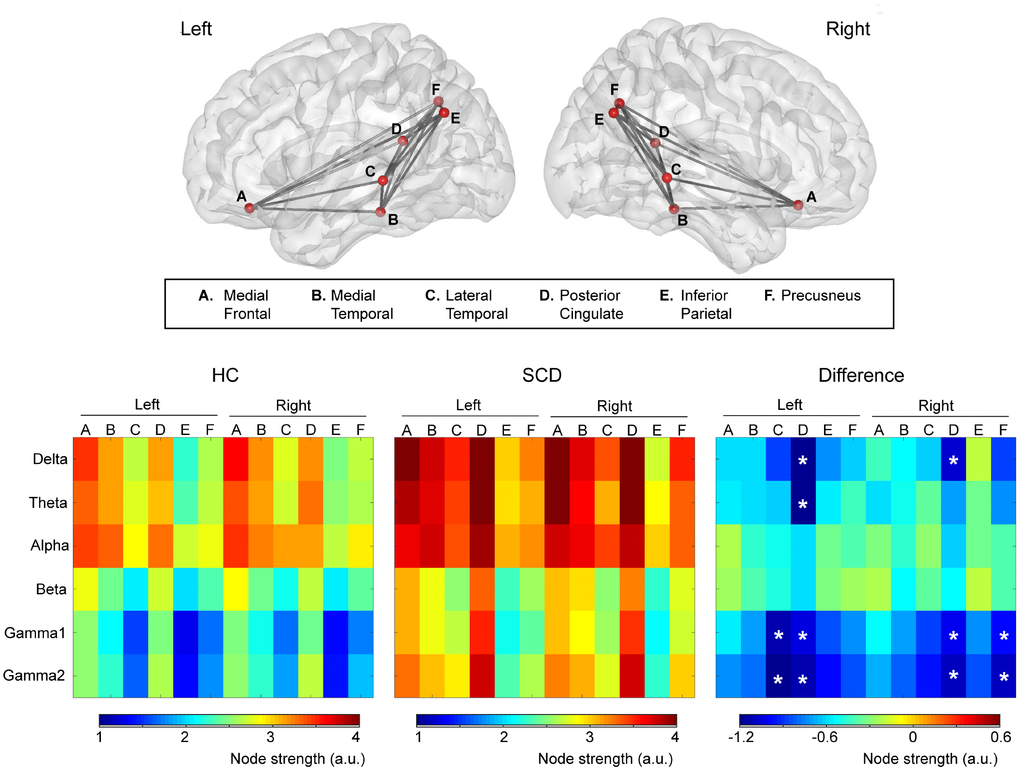 Upper panel: The intrinsic functional connectivity of default mode network viewed from the left and right side. Lower panel: Node strength of each brain area from delta to gamma2 bands was color-coded for healthy controls (HC) and individuals with subjective cognitive decline (SCD). The difference (HC minus SCD) of the node strength demonstrated the alterations of functional connectivity due to SCD. *p 
