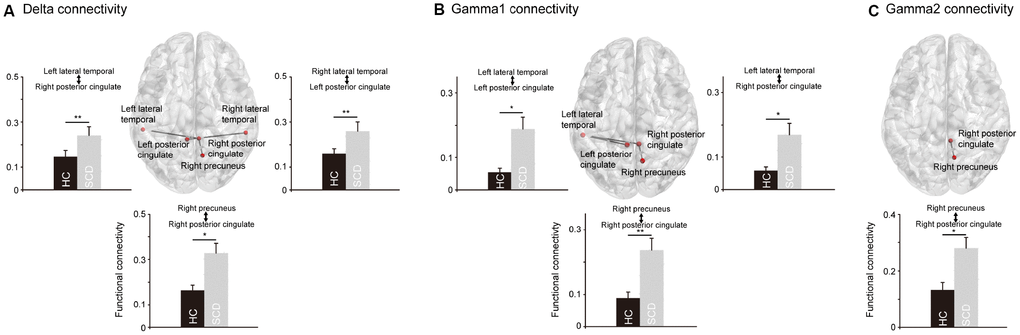 The significant differences regarding the functional connectivity between healthy controls (HC) and individuals with subjective cognitive decline (SCD). In the delta (A) and gamma1 (B) oscillations, SCD showed significantly stronger functional connectivity between posterior cingulate cortex and precuneus, and between posterior cingulate cortex and lateral temporal cortex. In the gamma2 oscillations (C), SCD showed significantly stronger functional connectivity between posterior cingulate cortex and precuneus. *p 